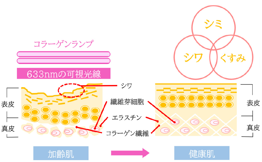 コラーゲンマシン
